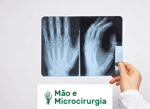 MÃO E MICROCIRURGIA