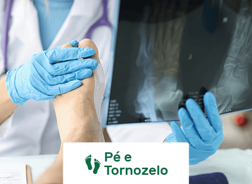 PÉ E TORNOZELO